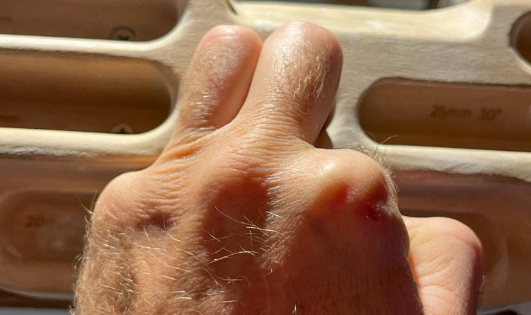 prise escalade entrainement climbing hold